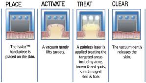 Natural Cystic Acne Treatment Options Natural Cystic Acne Treatment Options