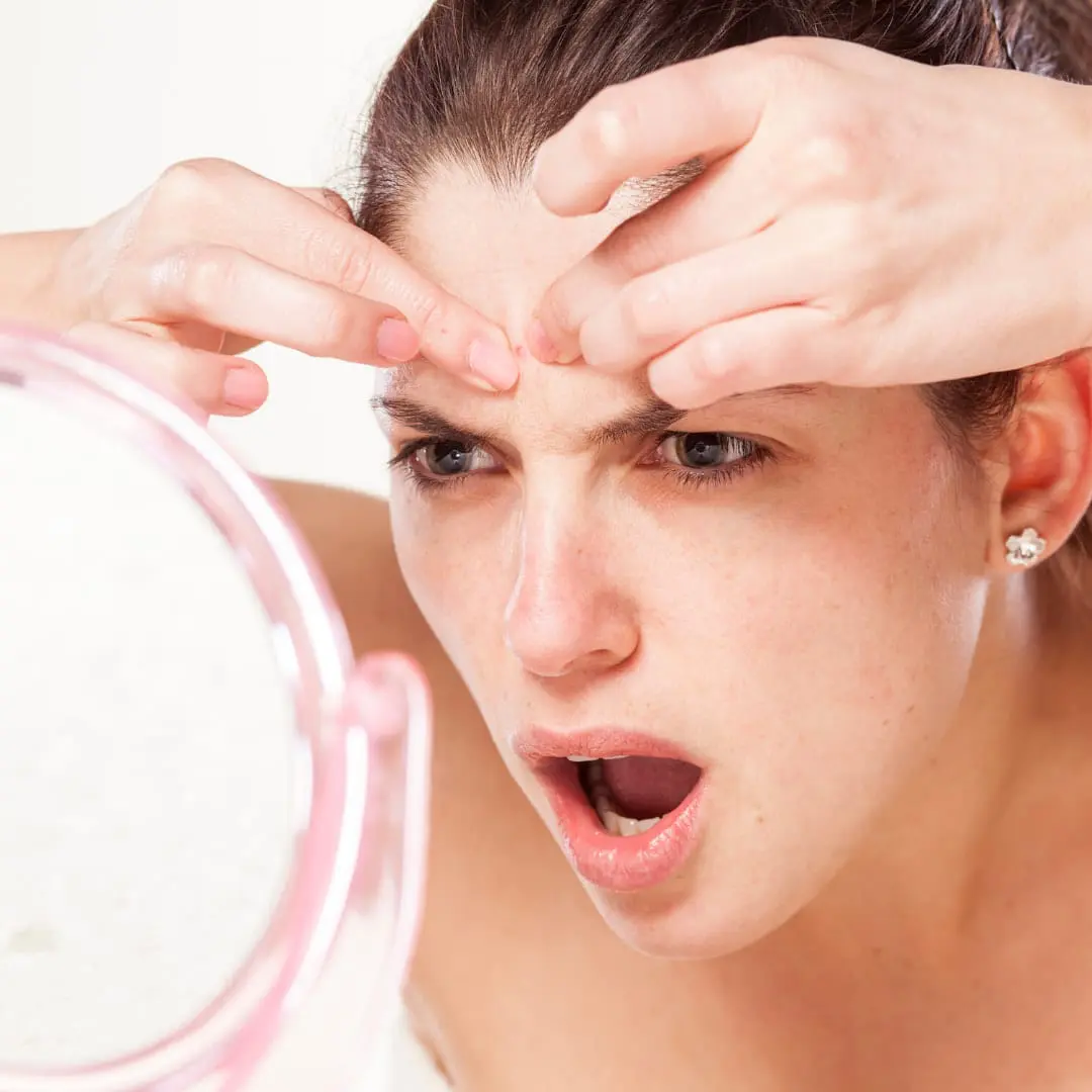 What Are the Key Signs you Have Stress Breakouts