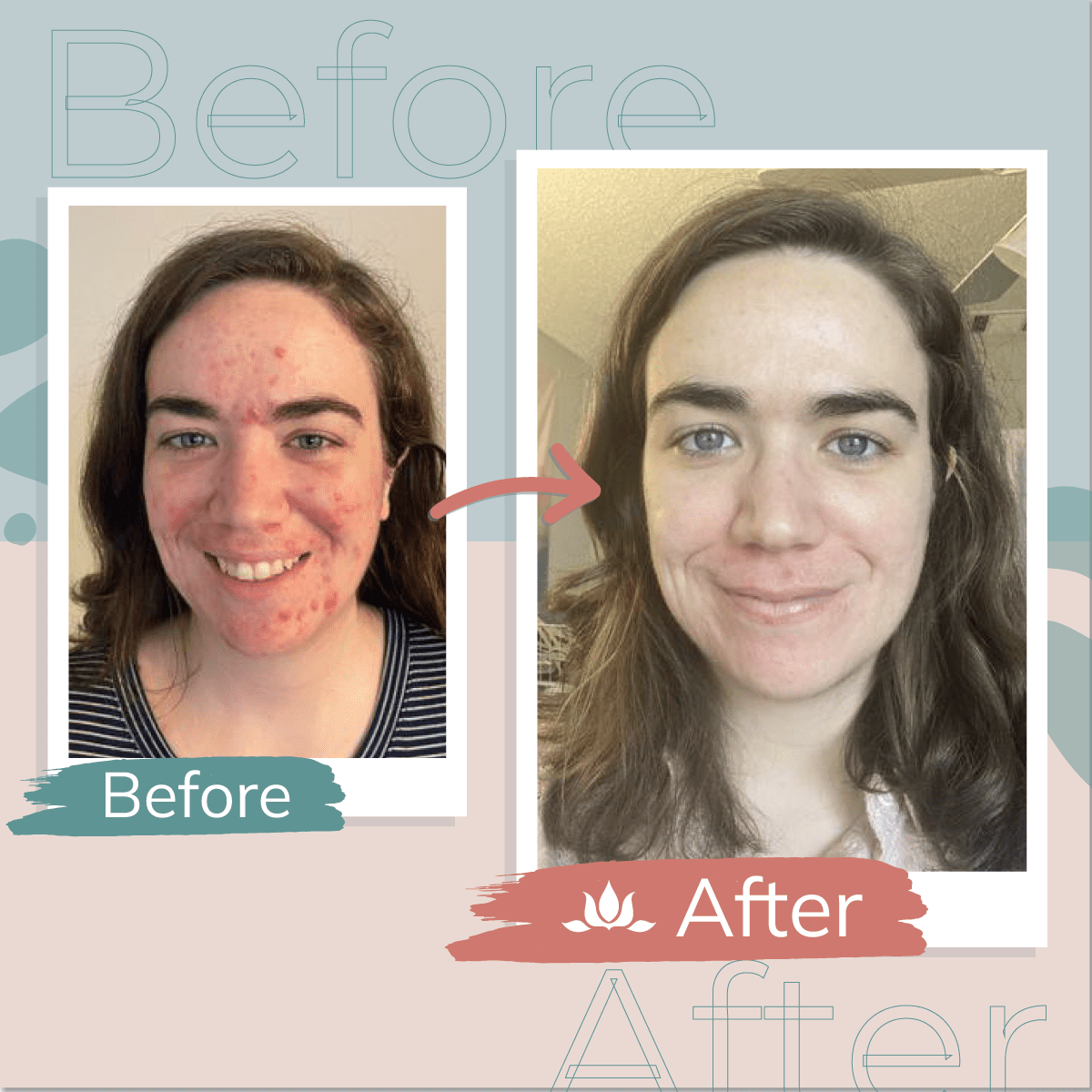 Before & After