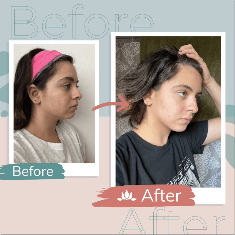 Before & After