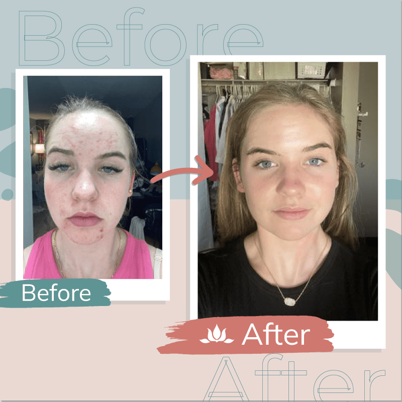 Before & After