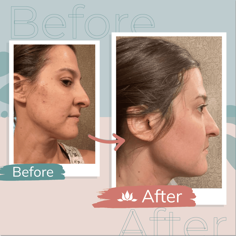 Before & After
