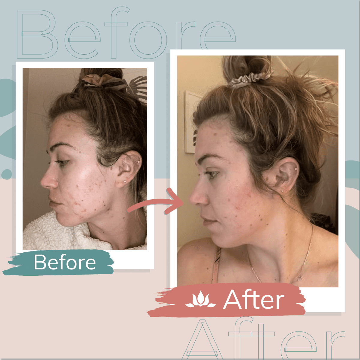 Before & After
