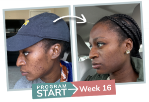 breakthrough session before and after