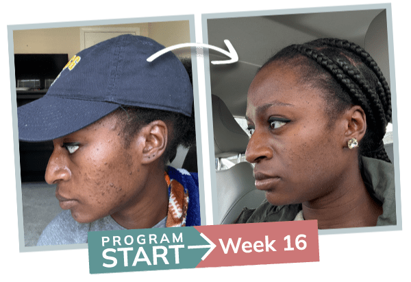 breakthrough session before and after