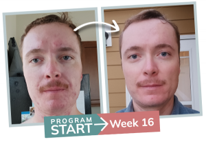 breakthrough session - before and after