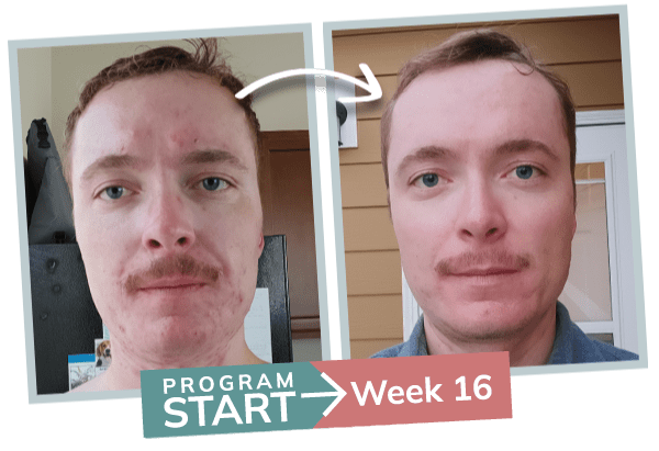 breakthrough session - before and after