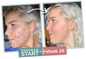 oac before and after Victoria Tiernan (white) v1 oac before and after Victoria Tiernan (white) v1
