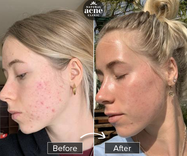Before & After