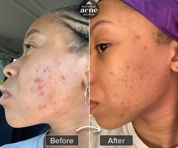 Before & After