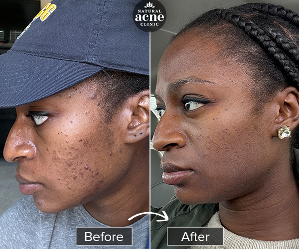 Before & After