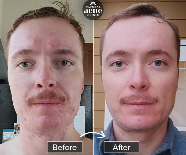 Before & After