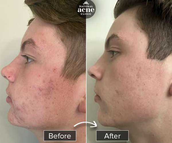 Before & After