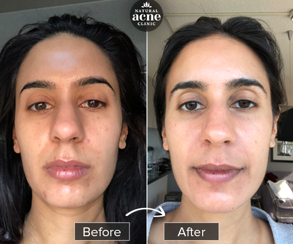 Before & After