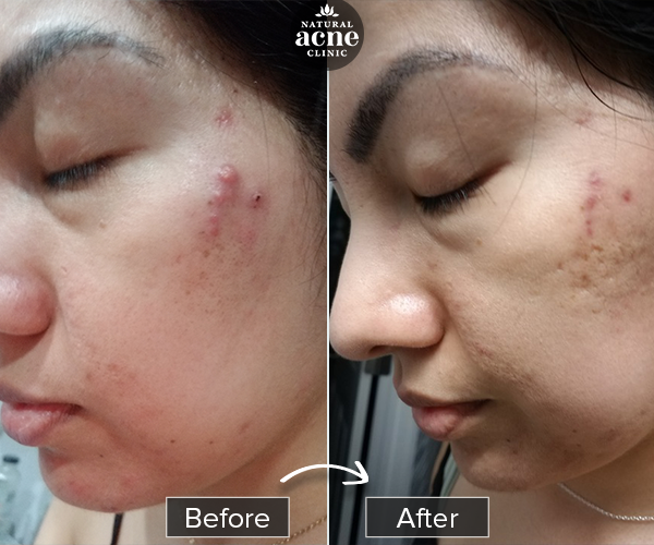 Before & After