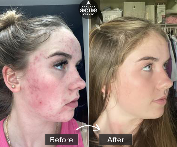 Before & After