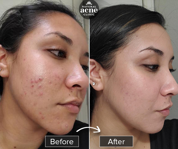 Before & After