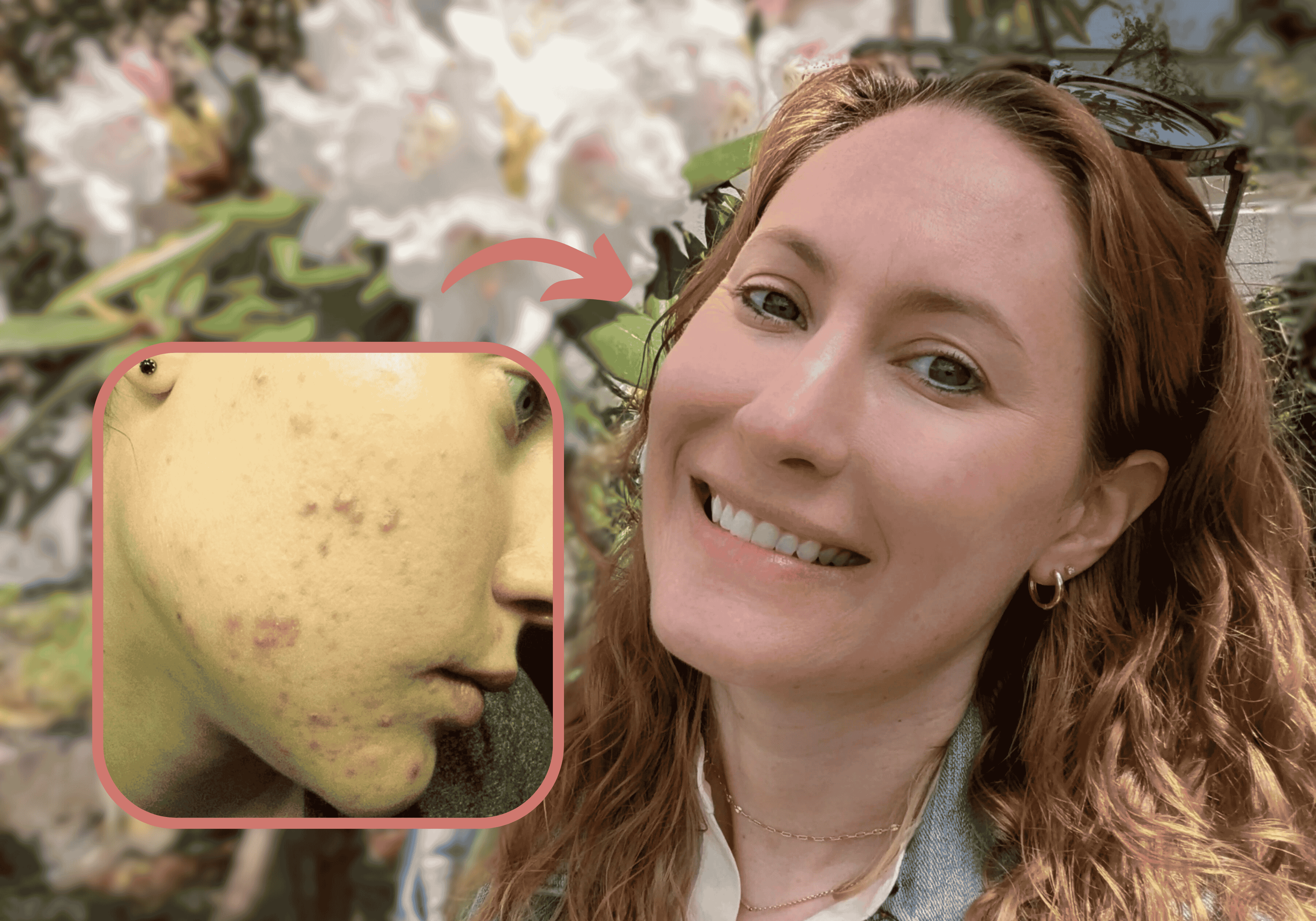 Morgan K. Before and After