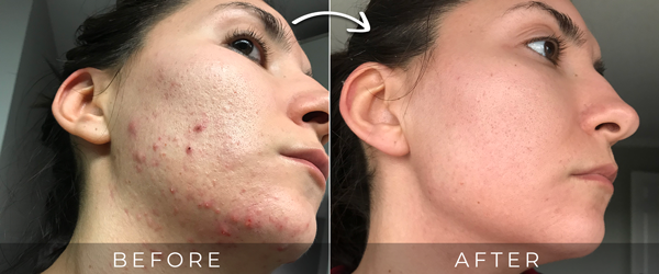 B&A
