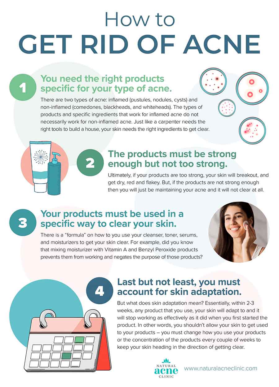 how to get rid of acne all over my body