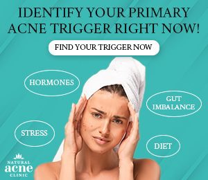 Free Acne Guide