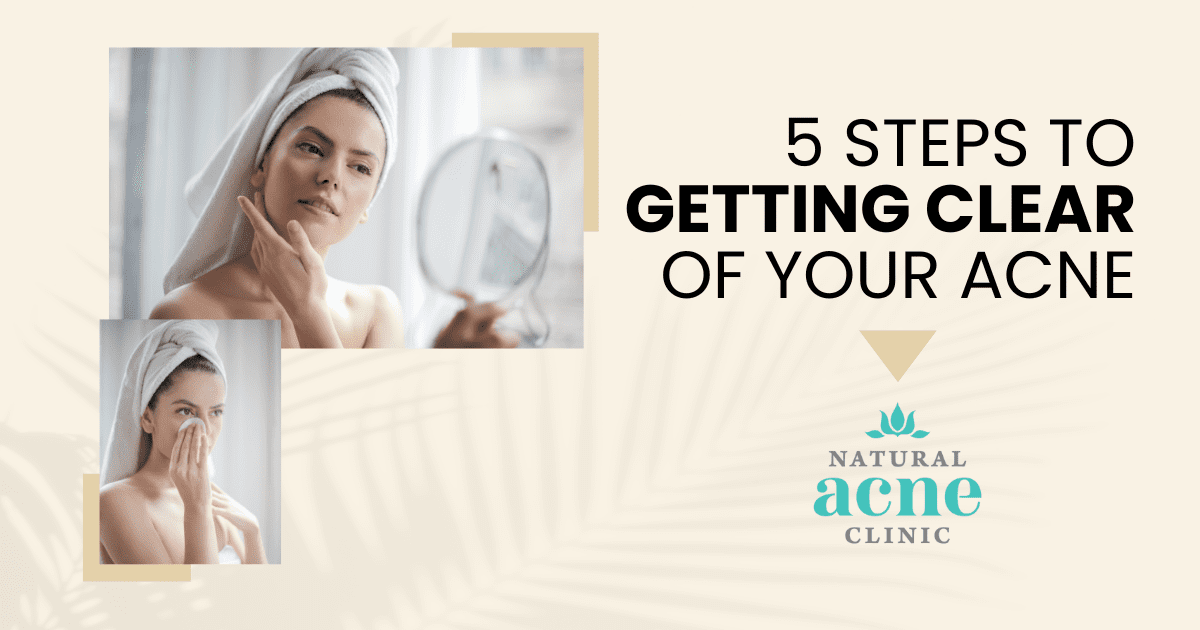 5 Steps To Getting Clear Of Your Acne 1 5 STEPS TO GETTING CLEAR OF YOUR ACNE