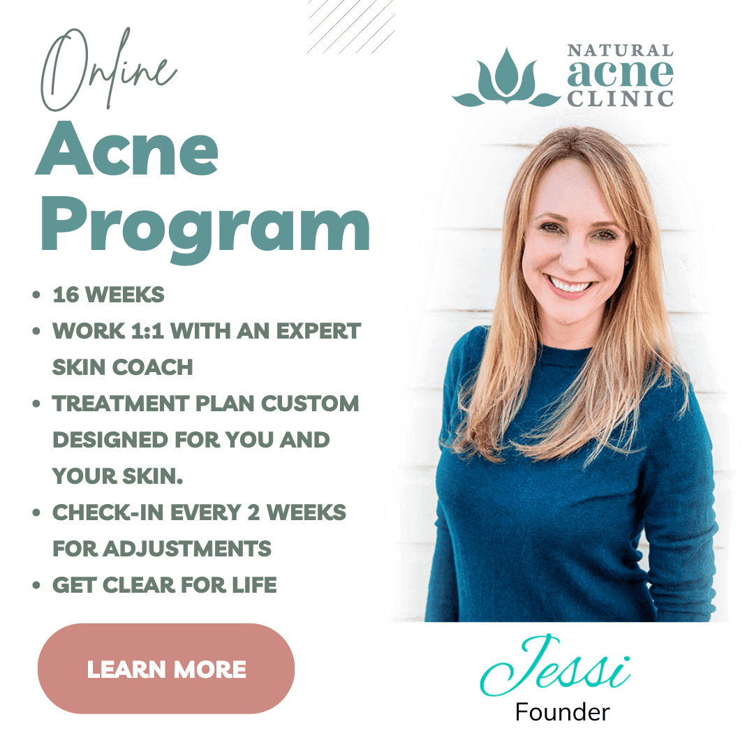 Online Acne Program