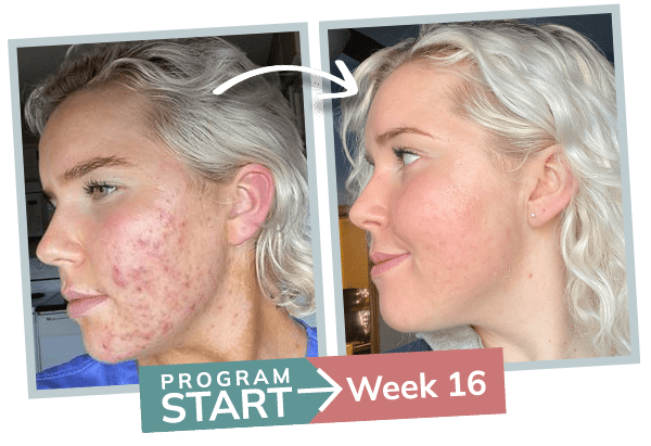 oac before and after Victoria Tiernan (white) v1