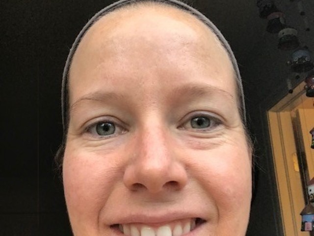 Online Acne Program Testimonial Image By Megan Ludwig