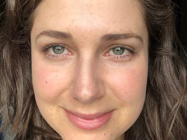 Online Acne Program Testimonial Image By Megan MacNaughton