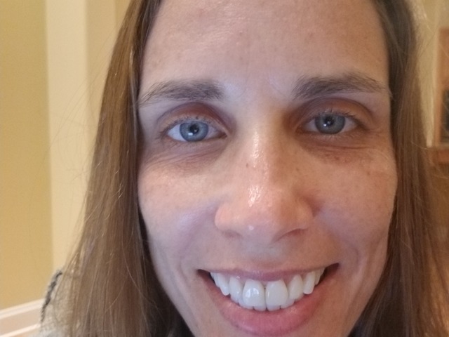 Online Acne Program Testimonial Image By Becca