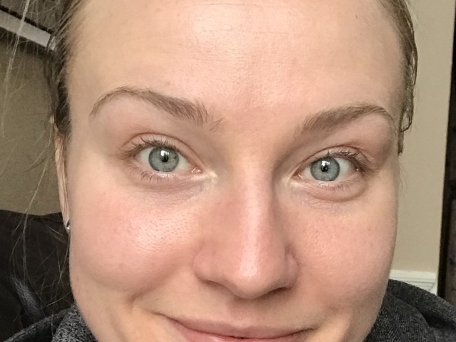 Online Acne Program Testimonial Image By Chelsea Murphy